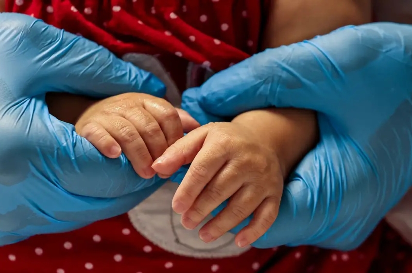 SUS começa a oferecer tratamento gratuito para AME tipo 1 com medicamento de R$ 7 milhões